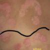 20191113_185109 DermaCure Gel