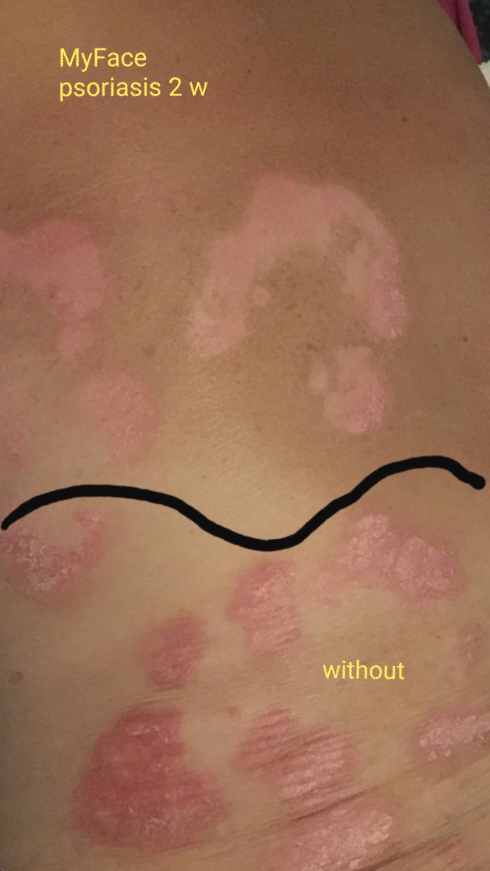 20191113_185109 DermaCure Gel